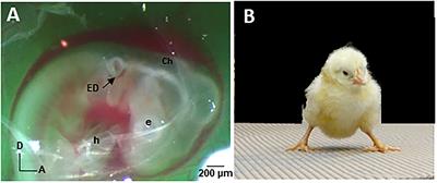 Understanding the Pathophysiology of Congenital Vestibular Disorders: Current Challenges and Future Directions